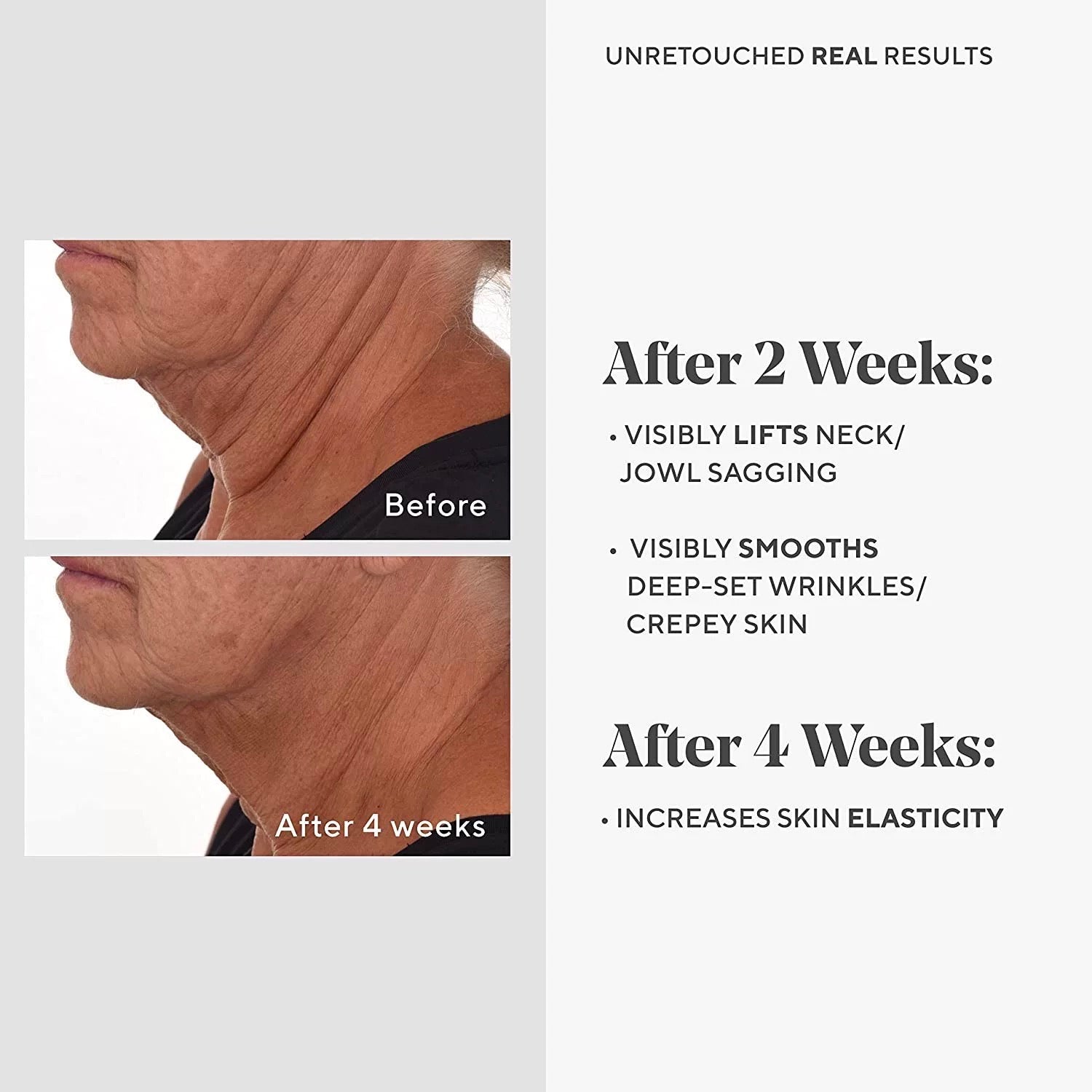 Murad A醛Pro精華30ml 視黃醛A醛精華Pro Murad Retinal ReSculpt Overnight Treatment Murad