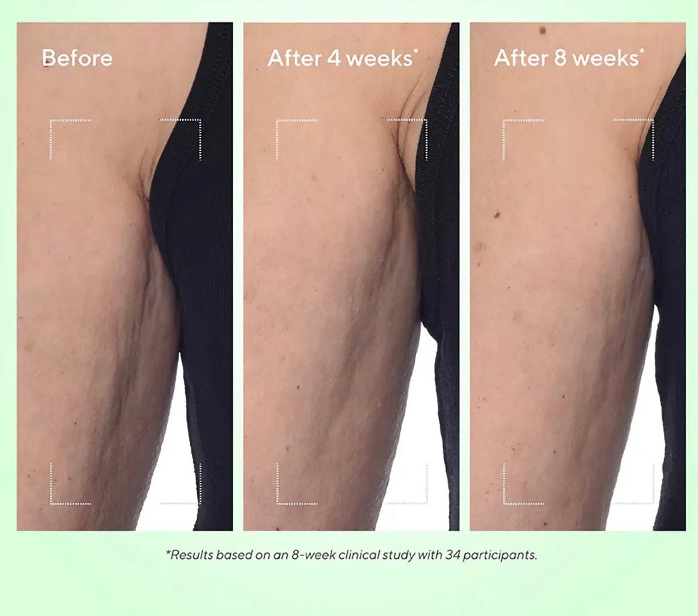 Murad 視黃醛緊塑身體乳霜 150ml Retinal ReSculpt Body Treatment Traitement corporel Retinal ReSculpt