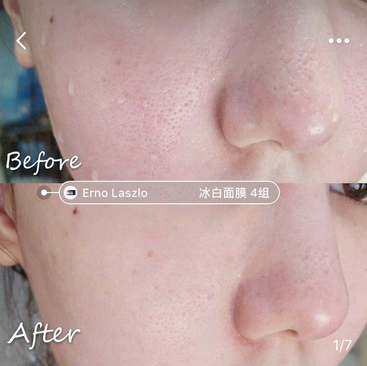 Erno Laszlo 水療再生冰白面膜 冰白面膜一盒4組 vitality treatment mask（STEP 1 ：4x37 ml + STEP 2 ：4×5.5g）